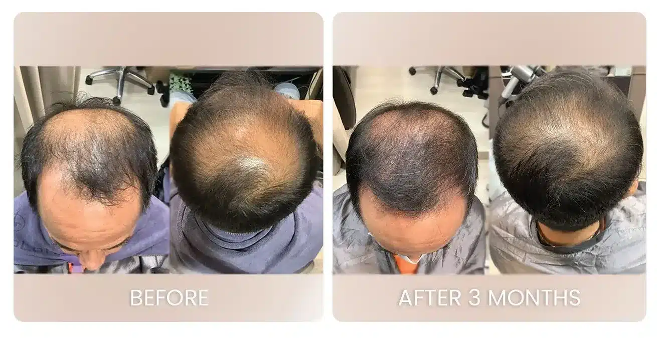 Before and after documented hair progress